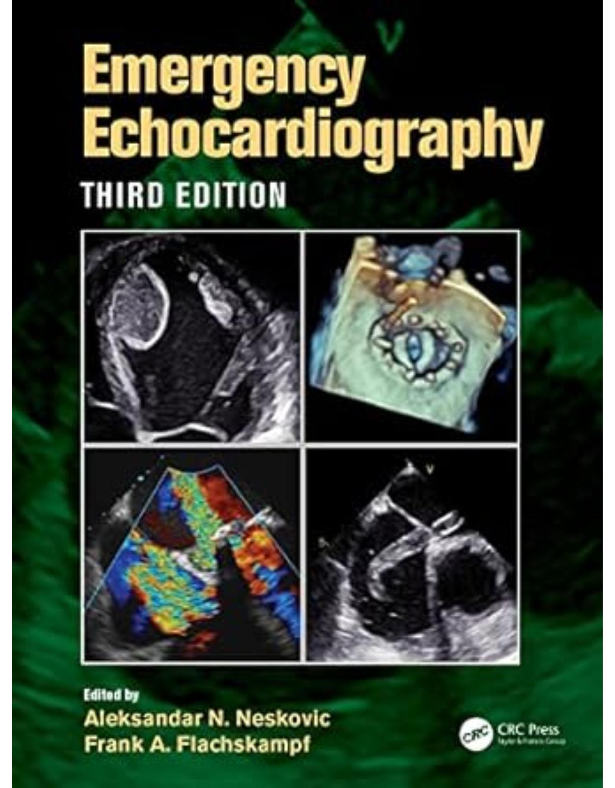 Emergency Echocardiography