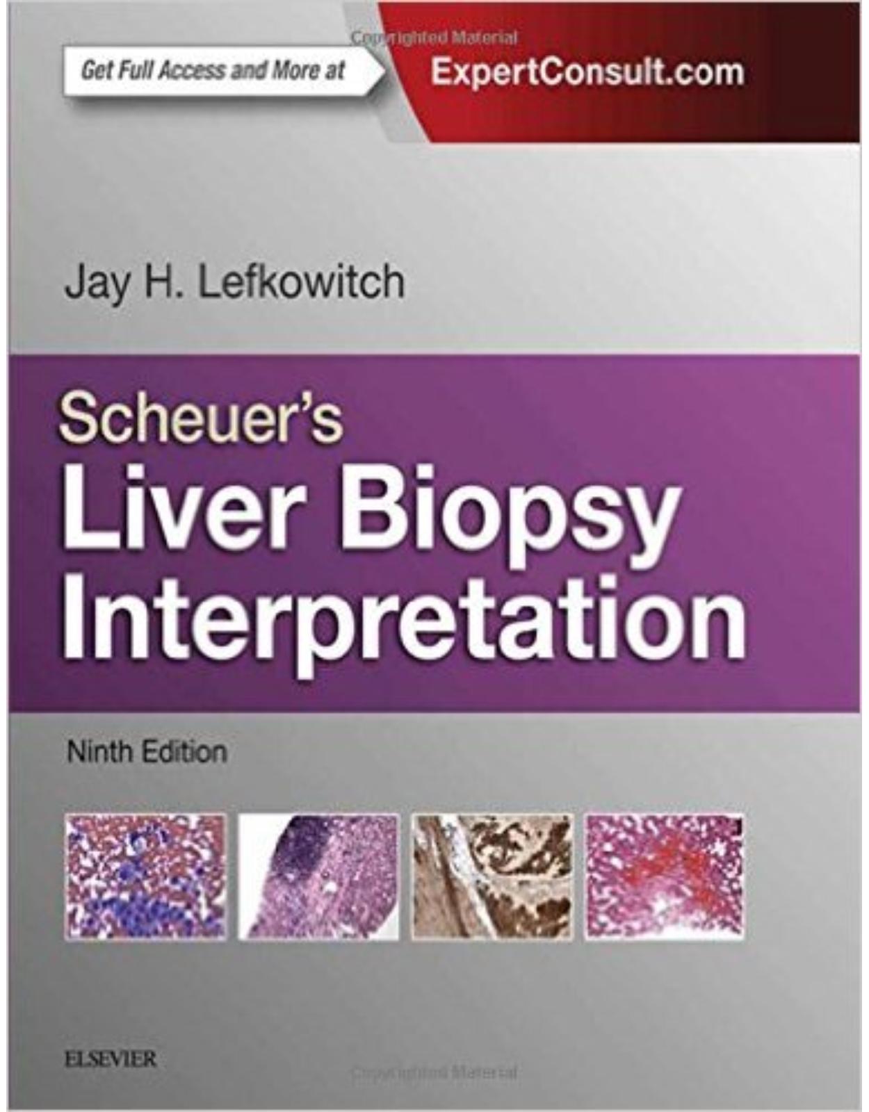 Scheuer's Liver Biopsy Interpretation, 9e