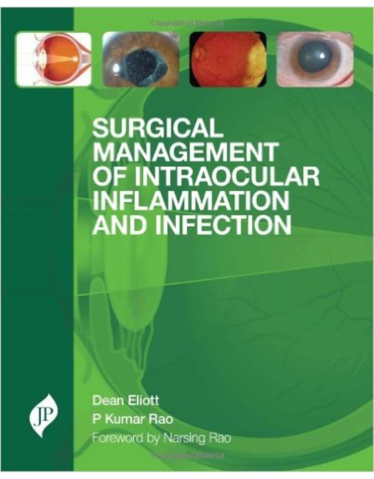 Surgical Management of Intraocular Inflammation and Infection