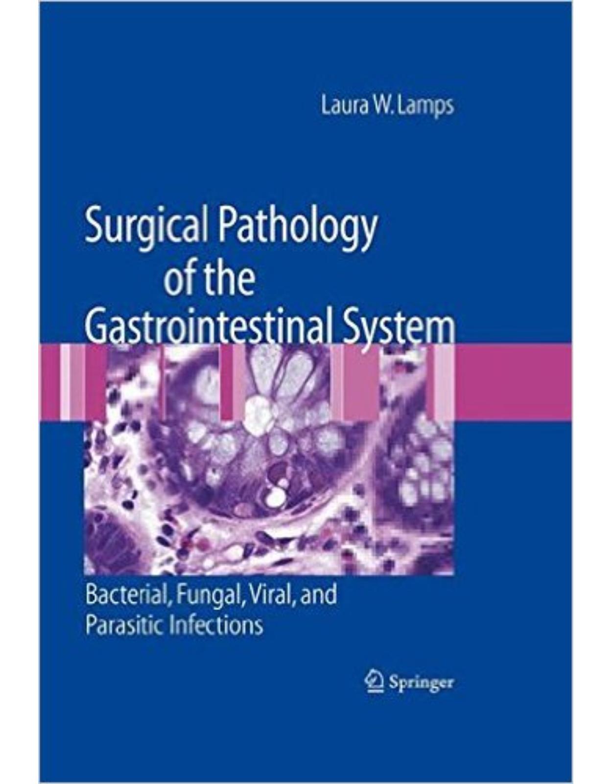 Surgical Pathology of the Gastrointestinal System: Bacterial, Fungal, Viral, and Parasitic Infections