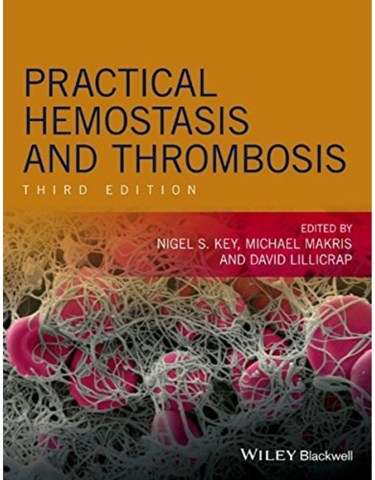 Practical Hemostasis and Thrombosis 