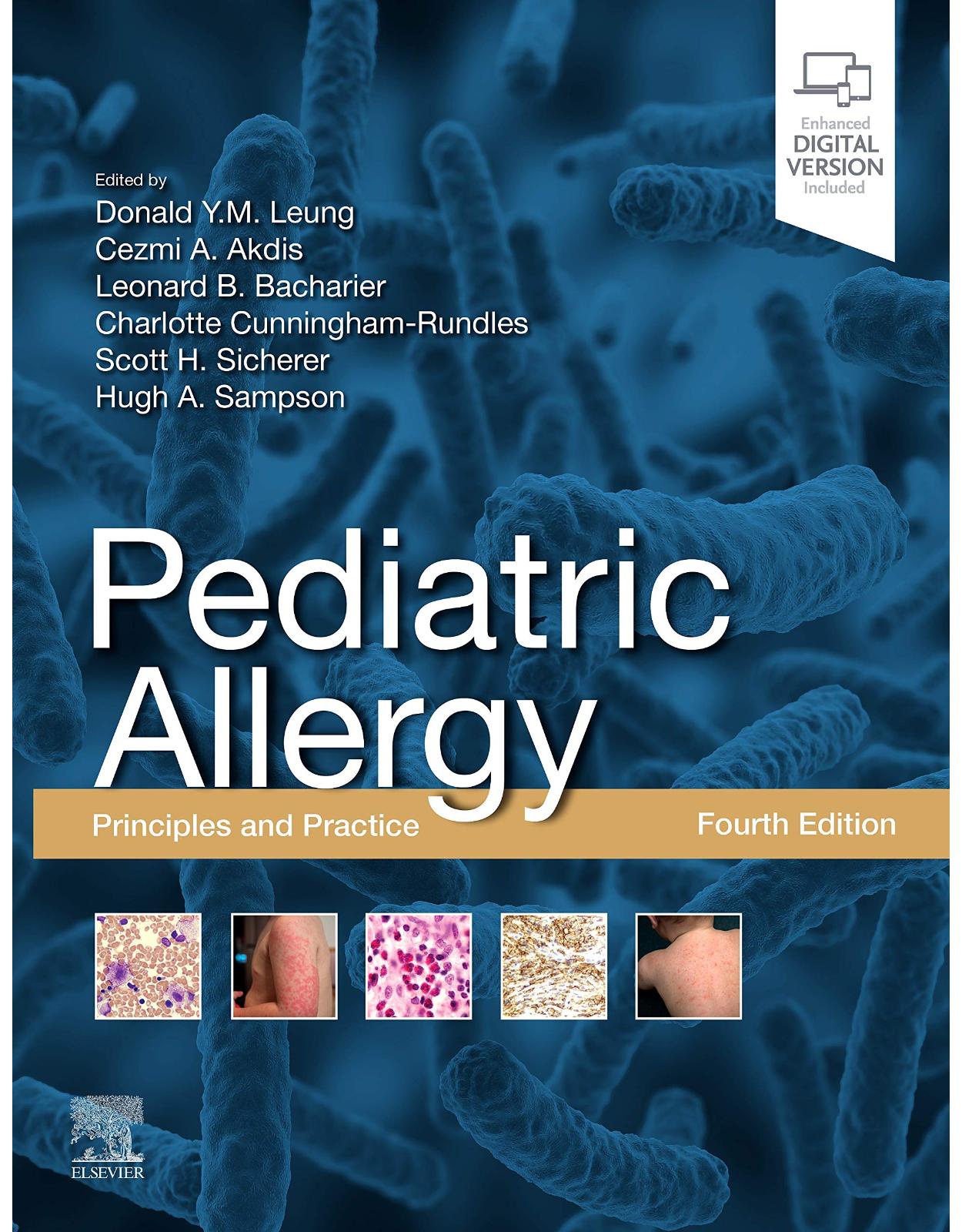 Pediatric Allergy: Principles and Practice: Principles and Practice