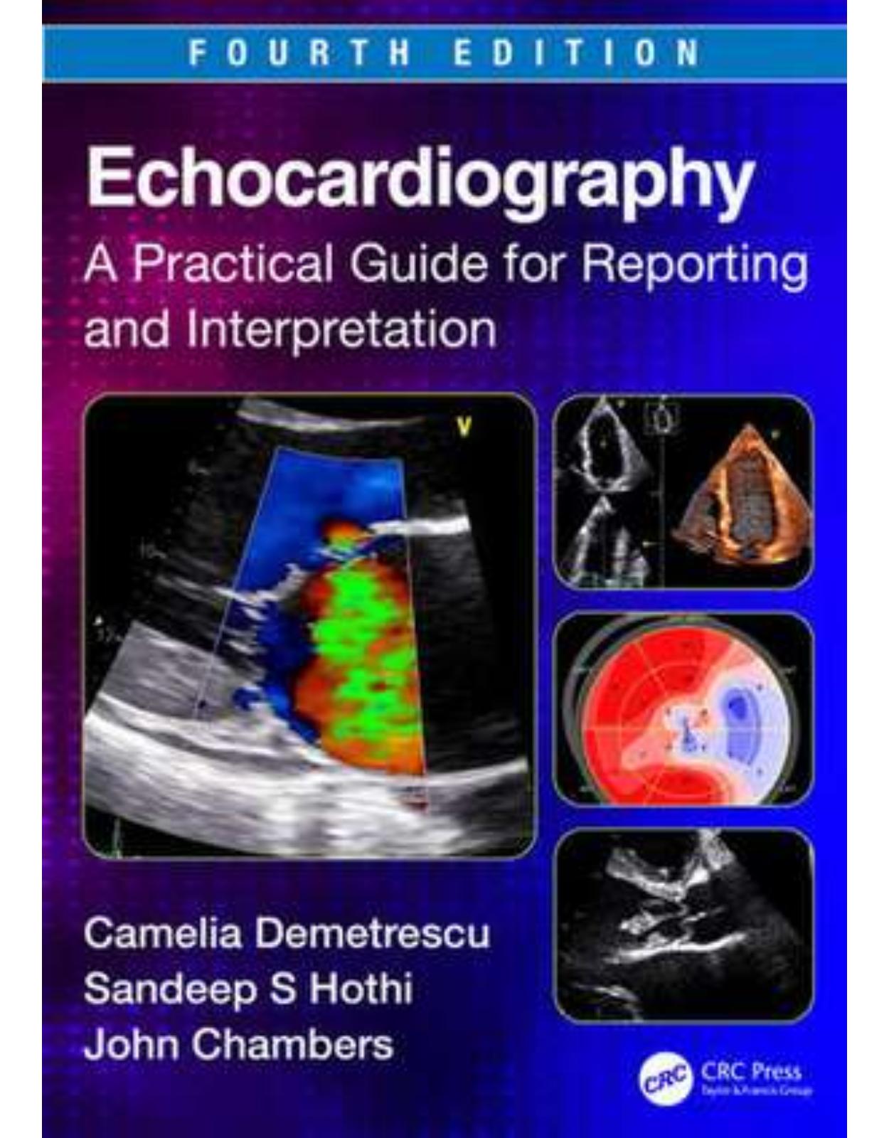 Echocardiography