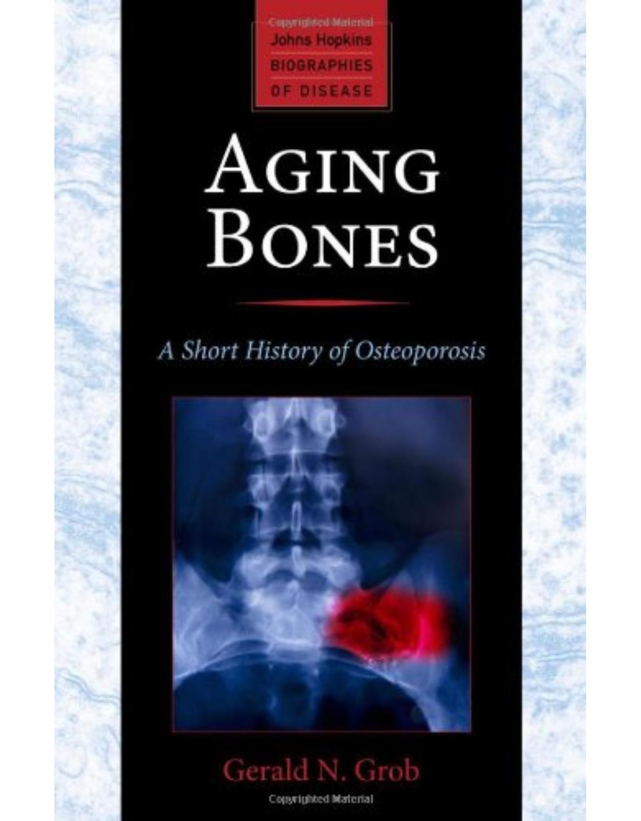 Aging Bones, A Short History of Osteoporosis