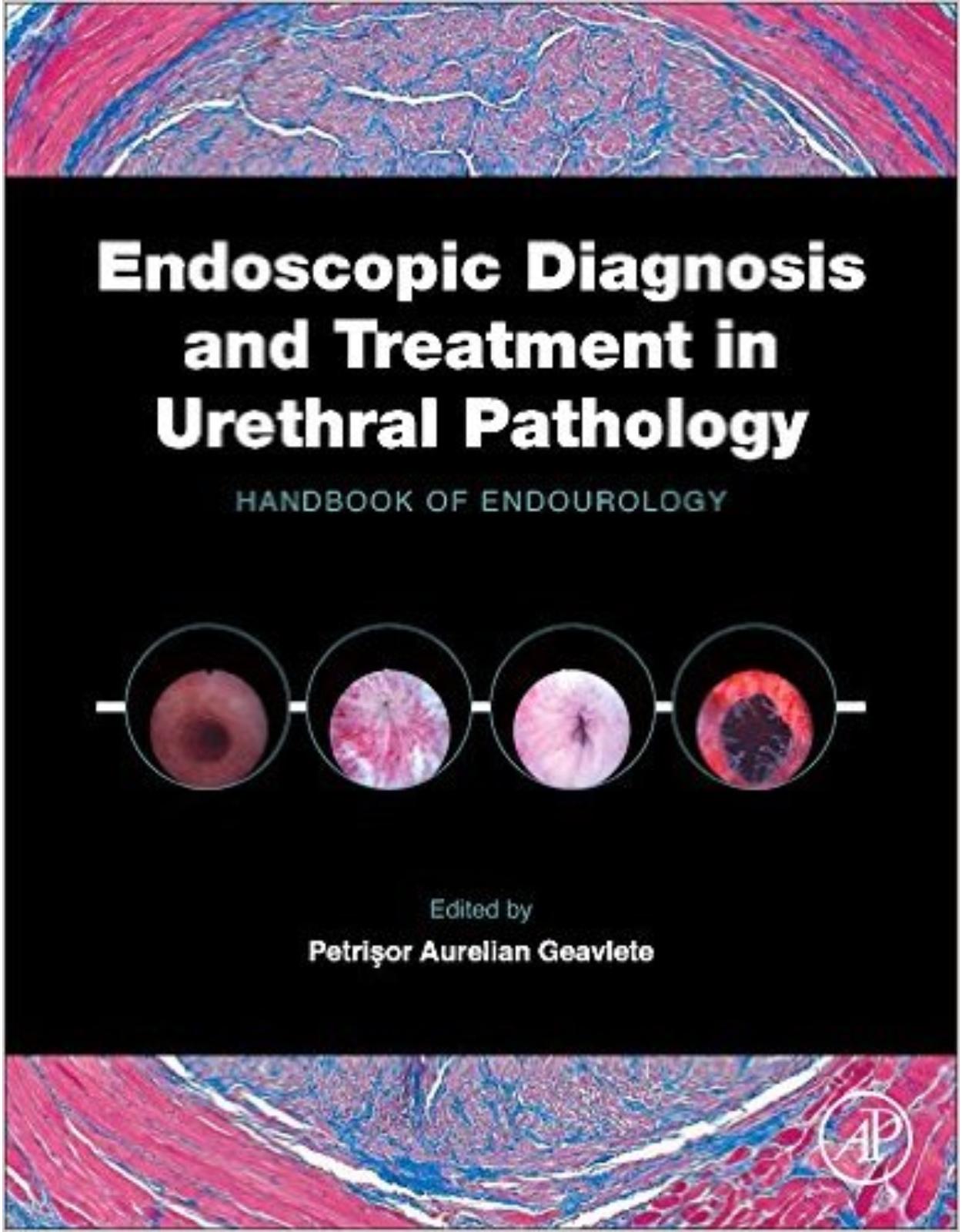 Endoscopic Diagnosis and Treatment in Urethral Pathology