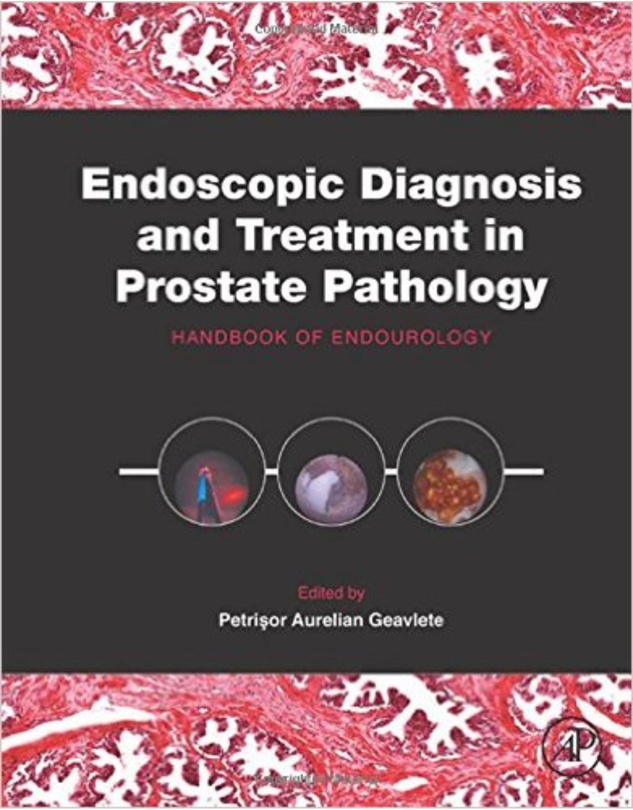 Endoscopic Diagnosis and Treatment in Prostate Pathology: Handbook of Endourology