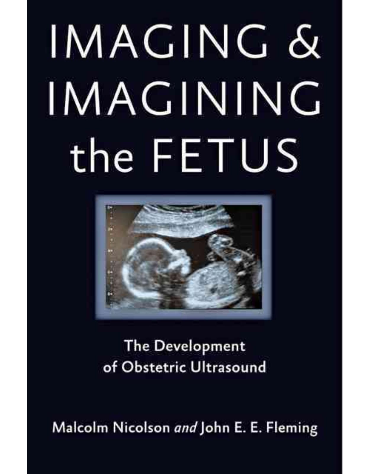 Imaging and Imagining the Fetus. The Development of Obstetric Ultrasound