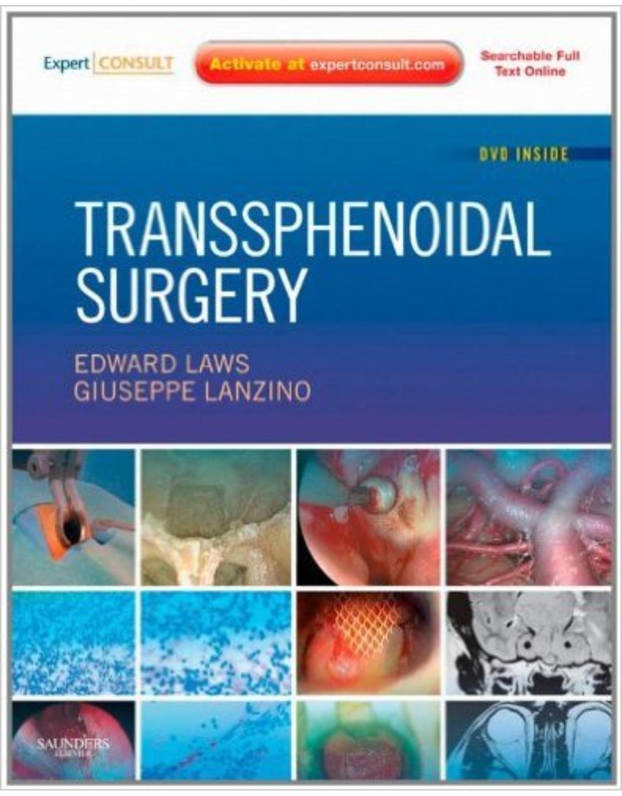 Transsphenoidal Surgery: Expert Consult - Online and Print, 1e