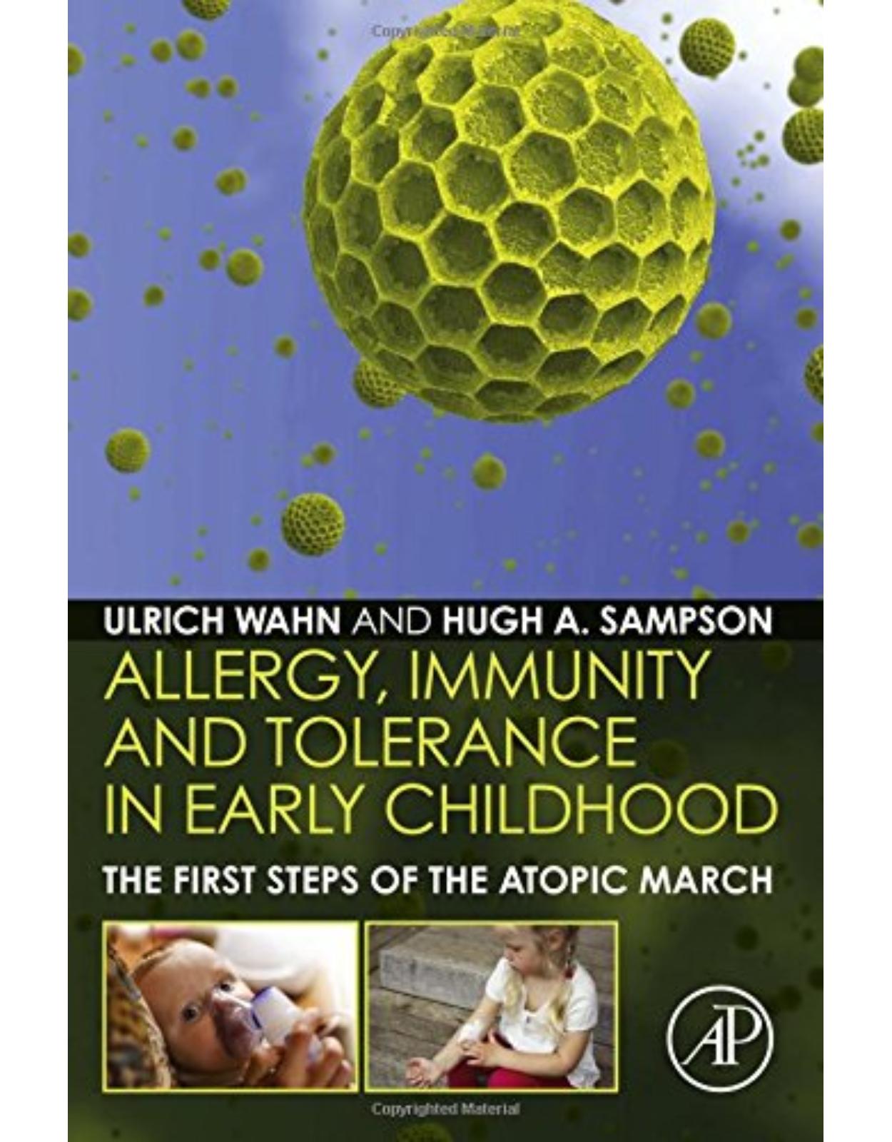Allergy, Immunity and Tolerance in Early Childhood: The First Steps of the Atopic March 