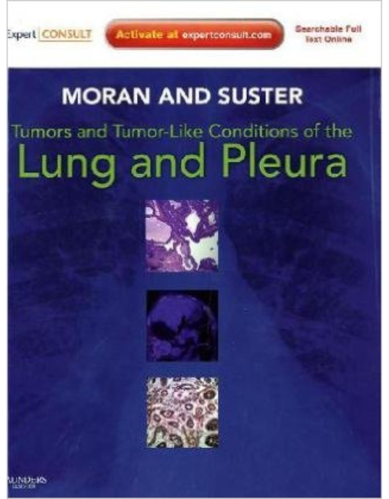 Tumors and Tumor-like Conditions of the Lung and Pleura: Expert Consult: Online and Print, 1e
