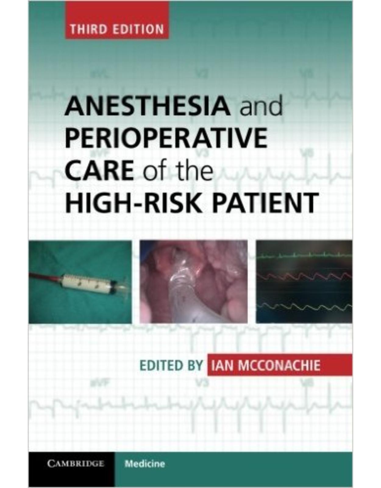 Anesthesia and Perioperative Care of the High-Risk Patient