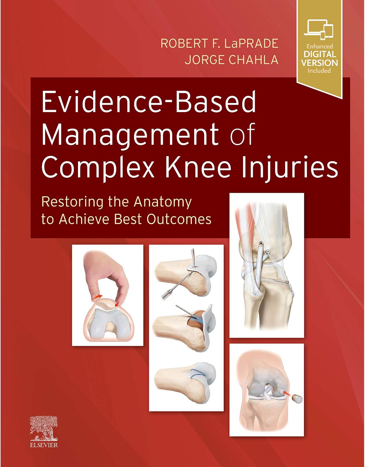 Evidence-Based Management of Complex Knee Injuries: Restoring the Anatomy to Achieve Best Outcomes