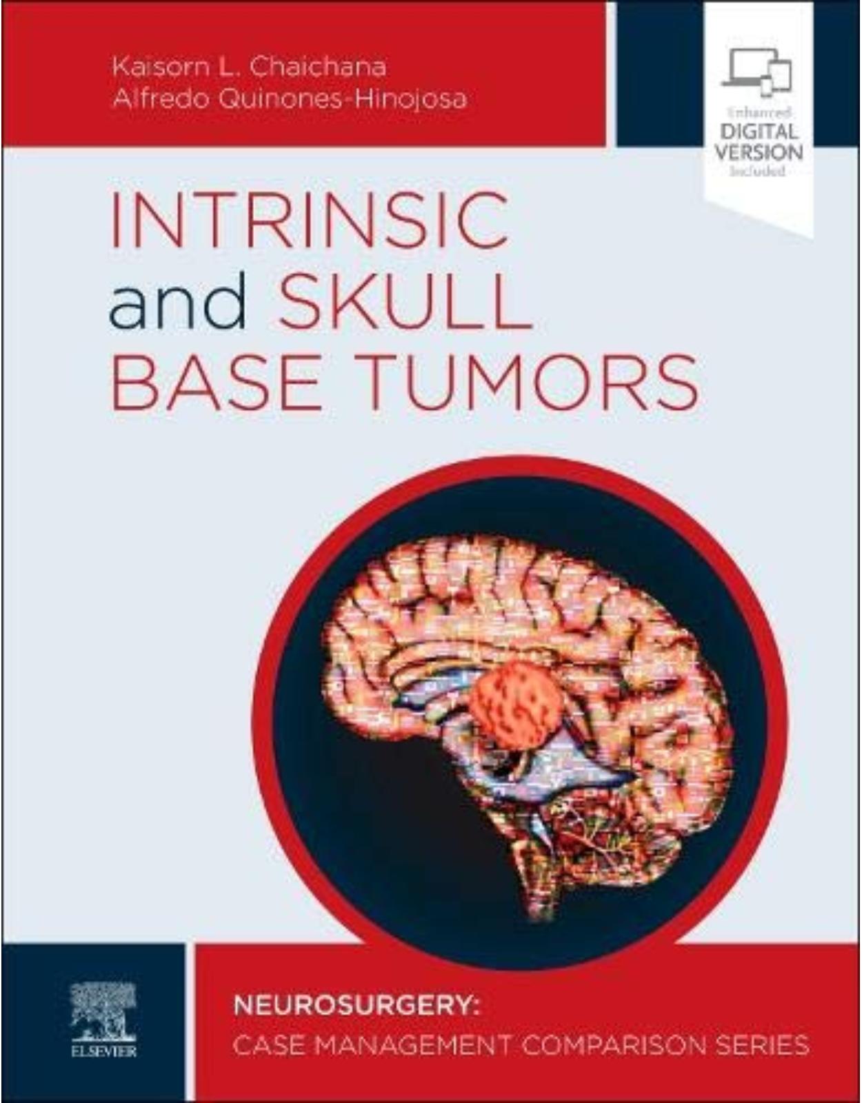 Intrinsic and Skull Base Tumors: Neurosurgery: Case Management Comparison Series