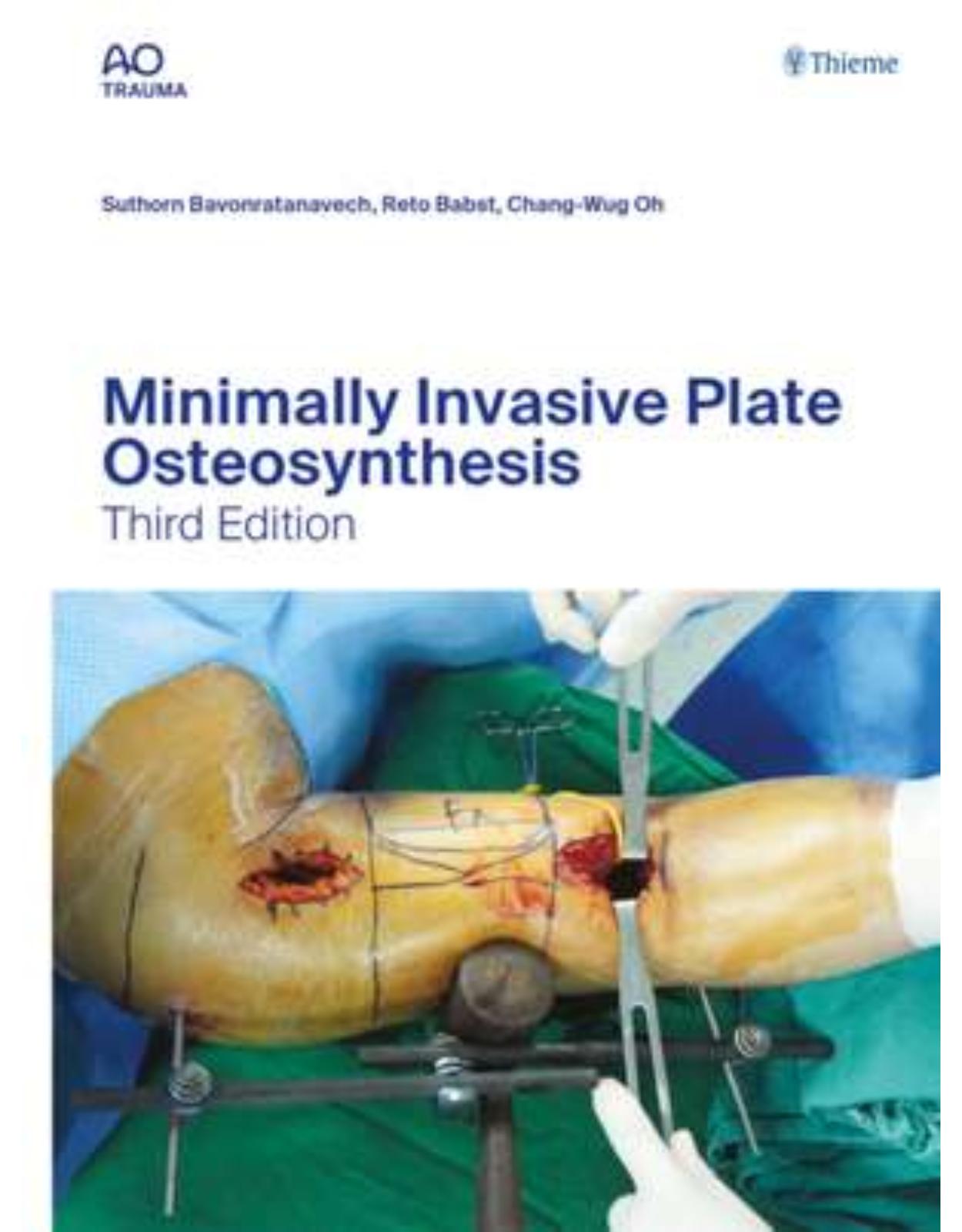 Minimally Invasive Plate Osteosynthesis