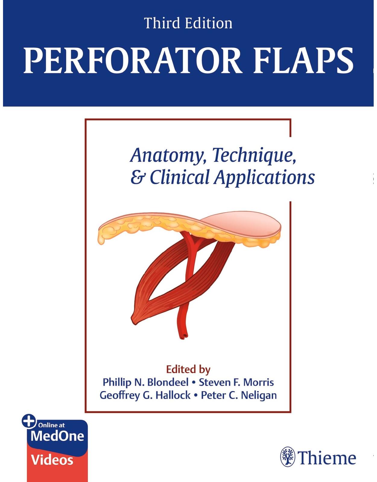 Perforator Flaps