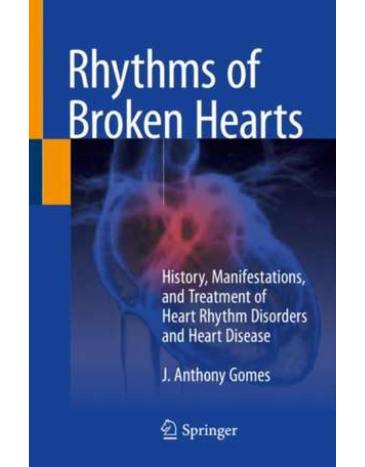 Rhythms of Broken Hearts