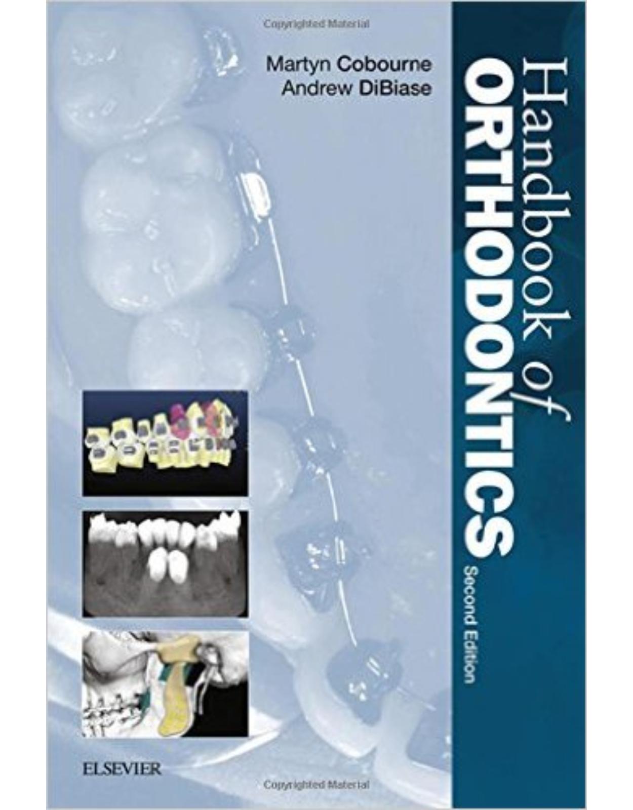 Handbook of Orthodontics, 2e 