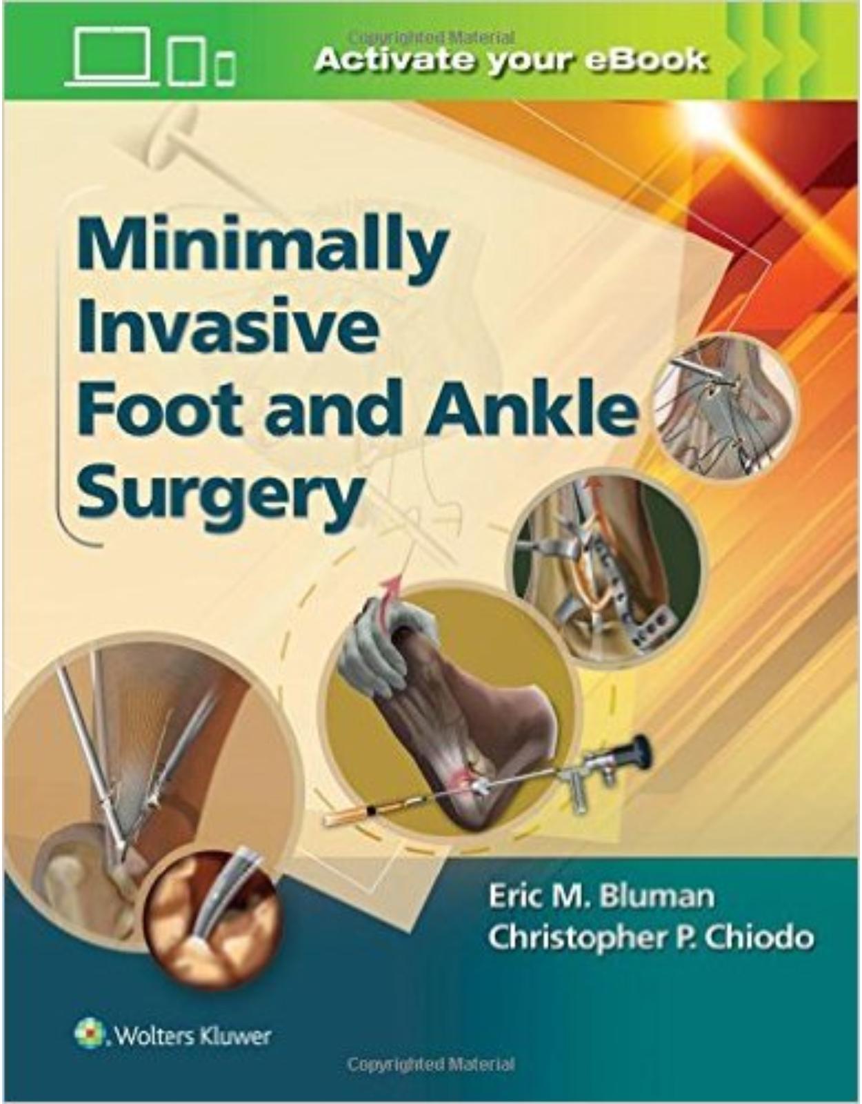 Minimally Invasive Foot & Ankle Surgery (Minimally Invasive Orthopaedic Surgery)