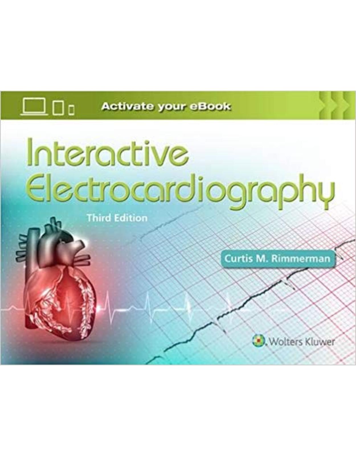 Interactive Electrocardiography