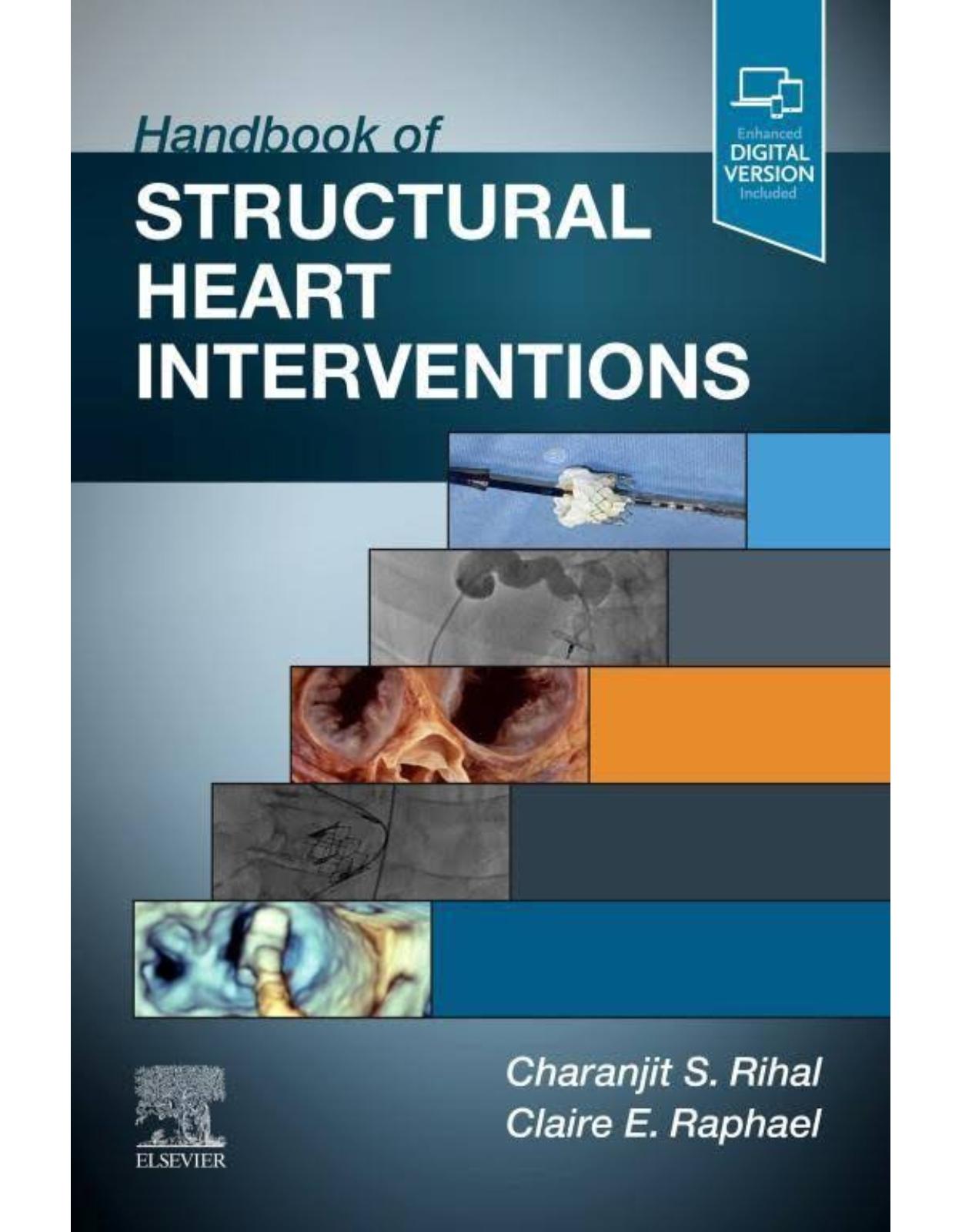 Handbook of Structural Heart Interventions 