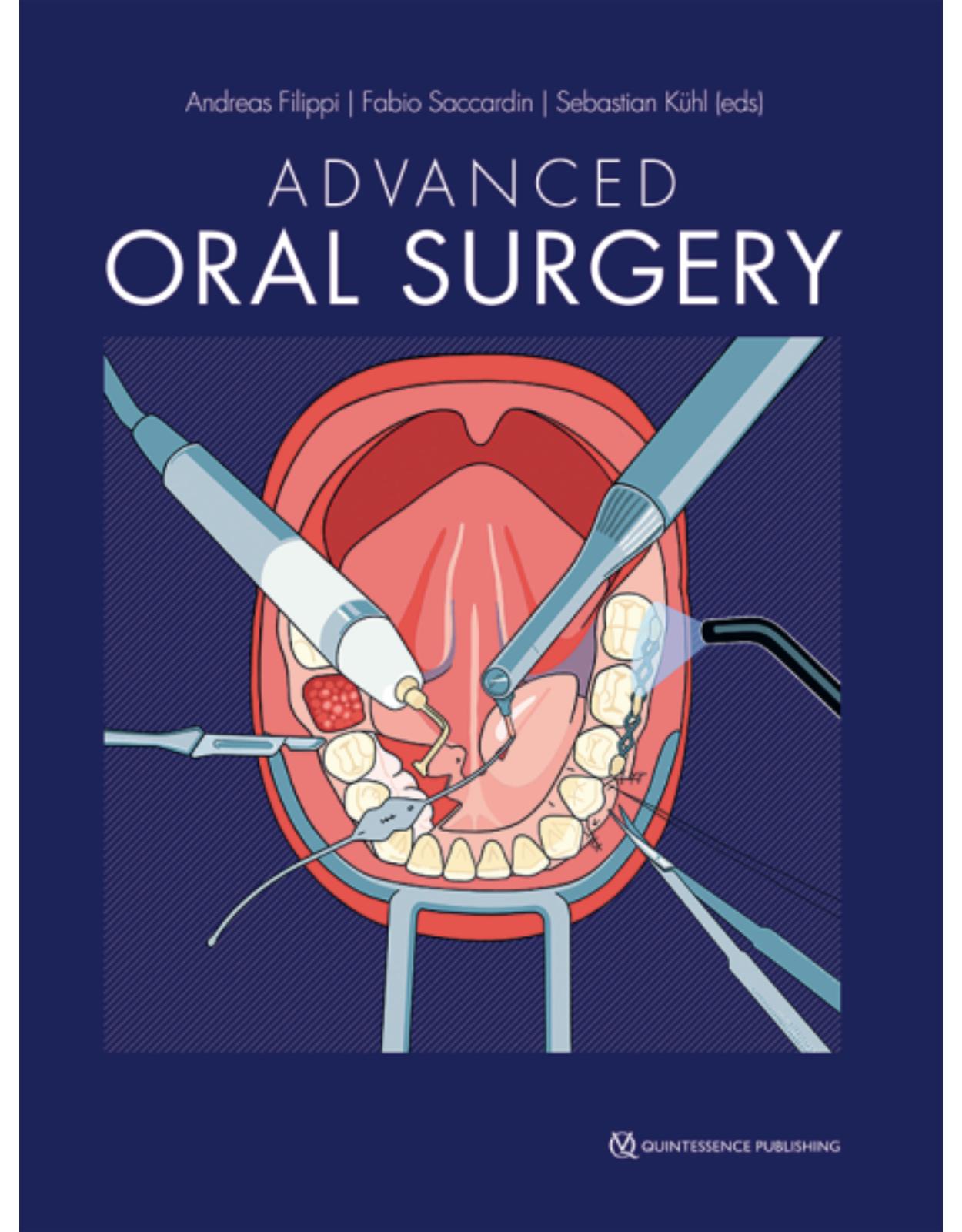 Advanced Oral Surgery