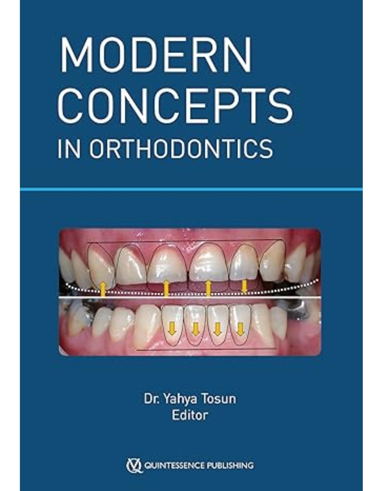 Modern Concepts in Orthodontics