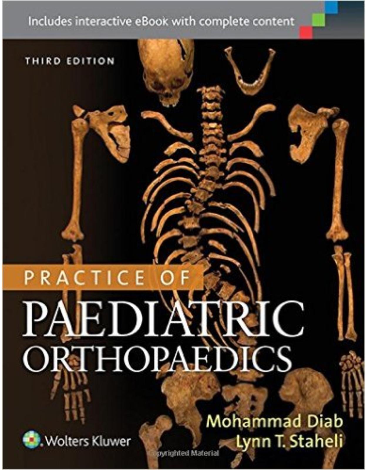 Practice of Paediatric Orthopaedics