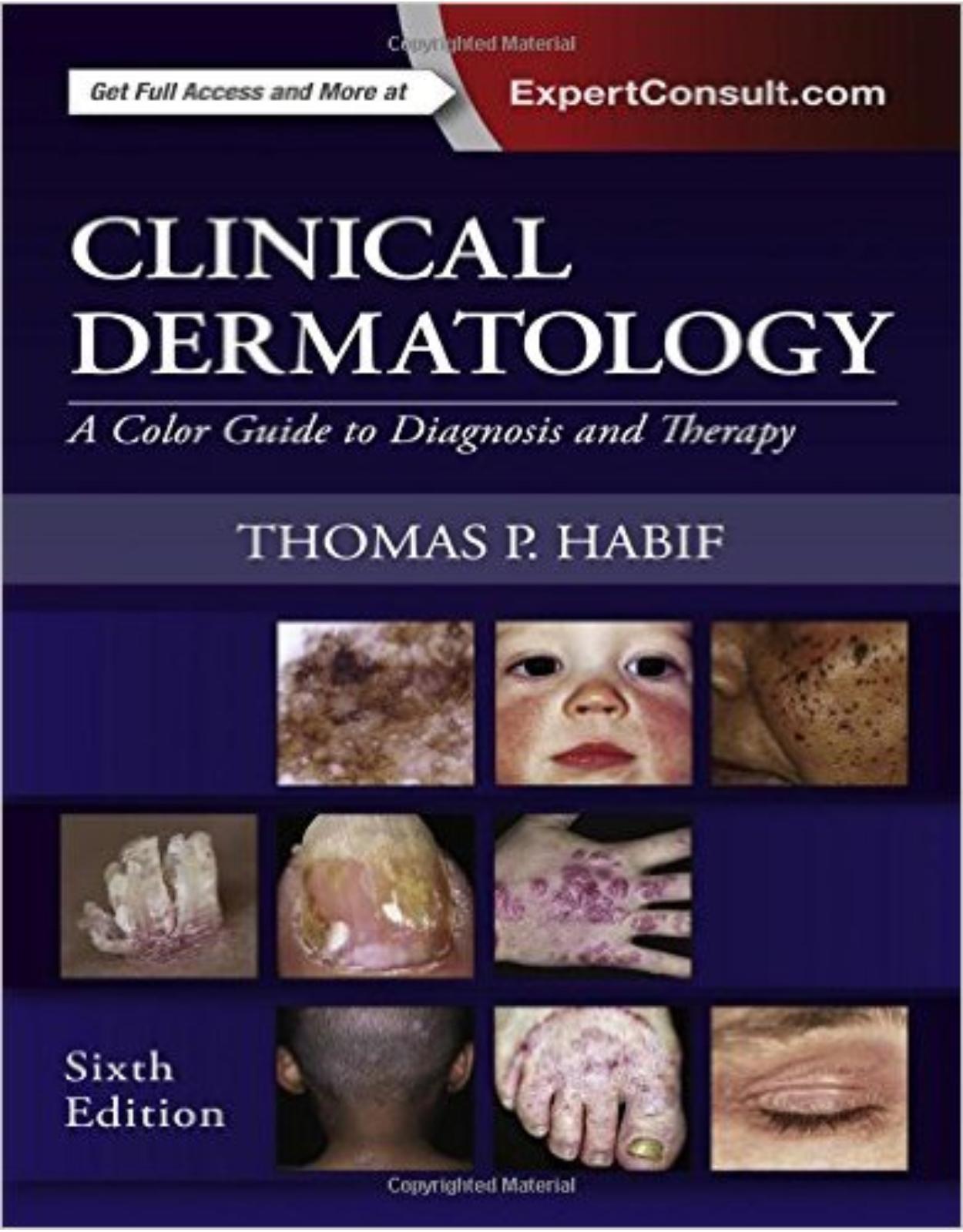 Clinical Dermatology: A Color Guide to Diagnosis and Therapy, 6e