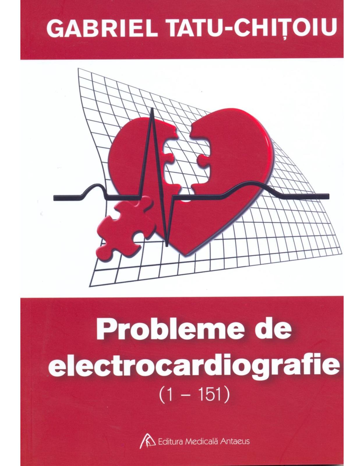Probleme de electrocardiografie (1-151)