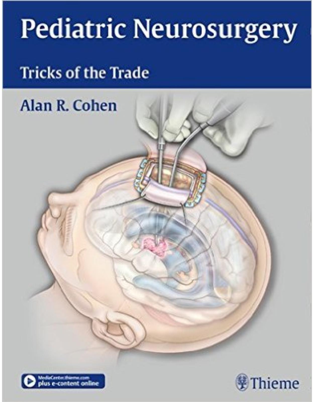 Pediatric Neurosurgery: Tricks of the Trade