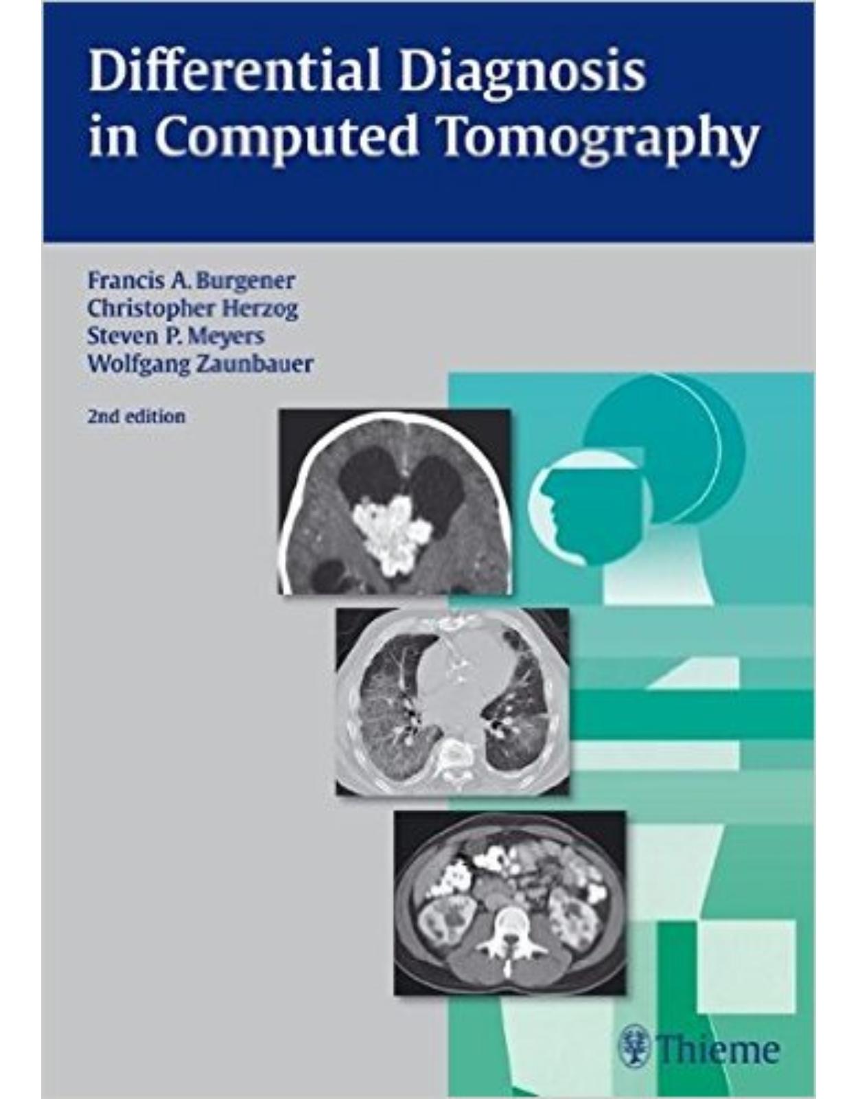 Differential Diagnosis in Computed Tomography