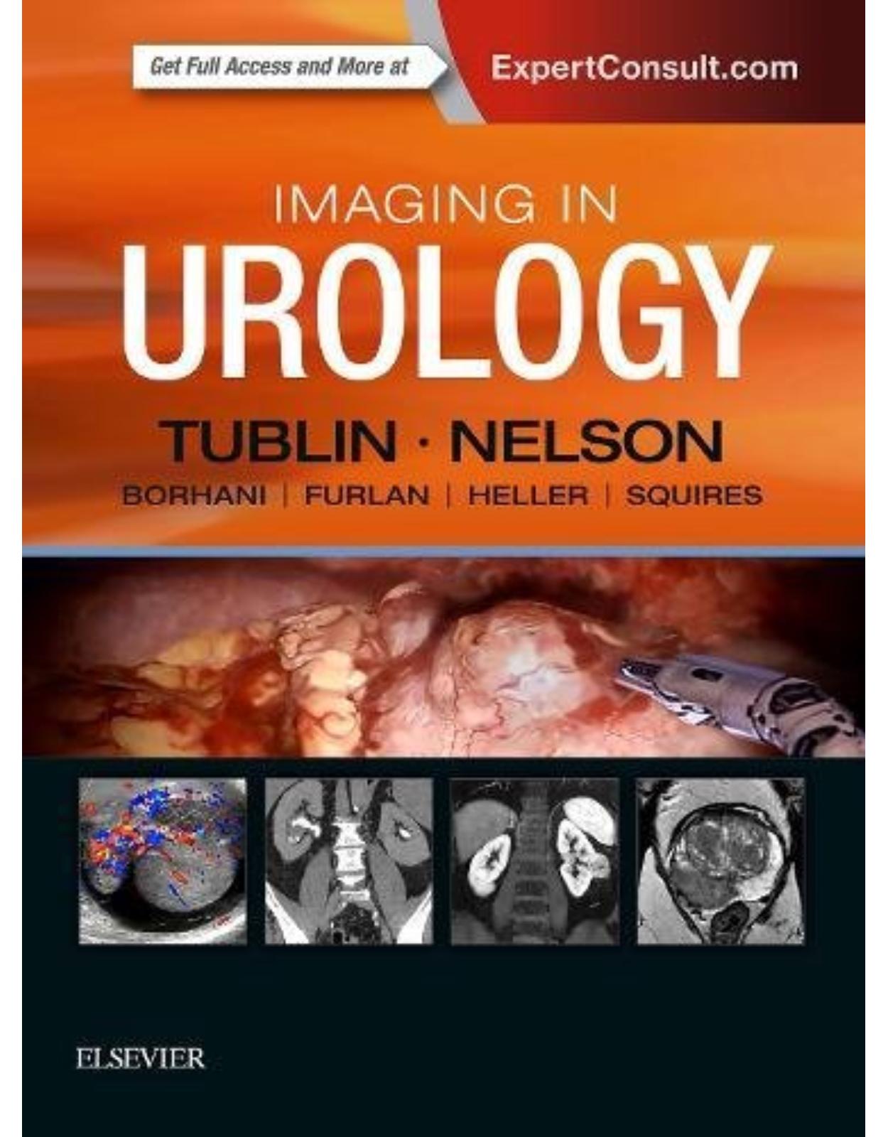 Imaging in Urology, 1e