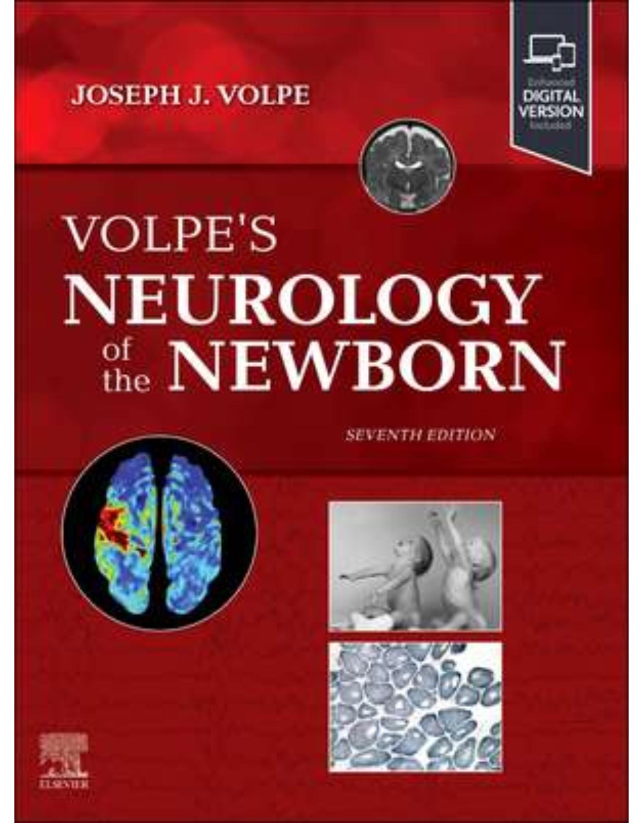 Volpe’s Neurology of the Newborn, 7th Edition