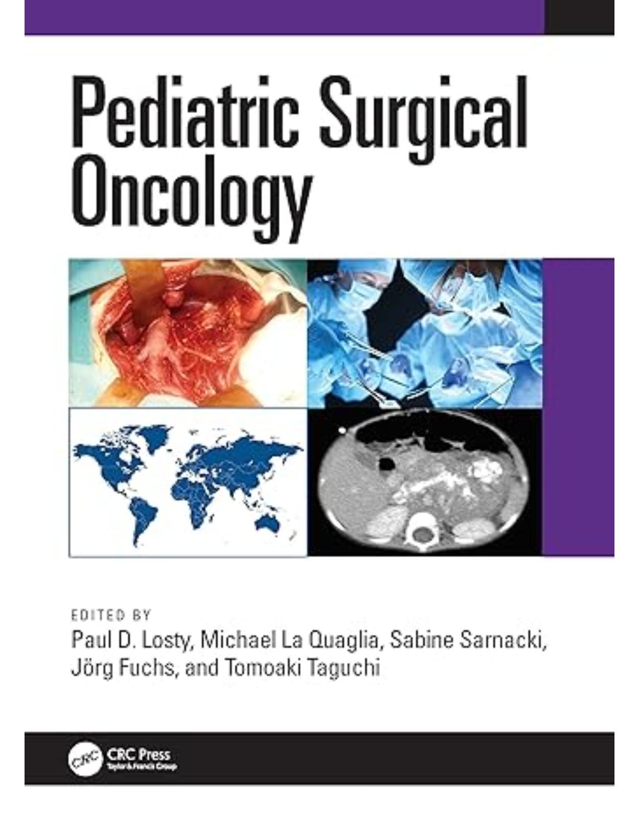 Pediatric Surgical Oncology