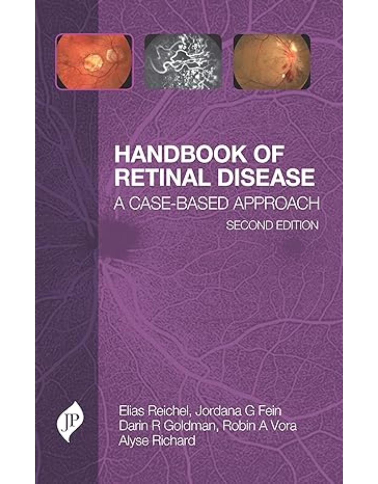 Handbook of Retinal Disease: A Case-Based Approach