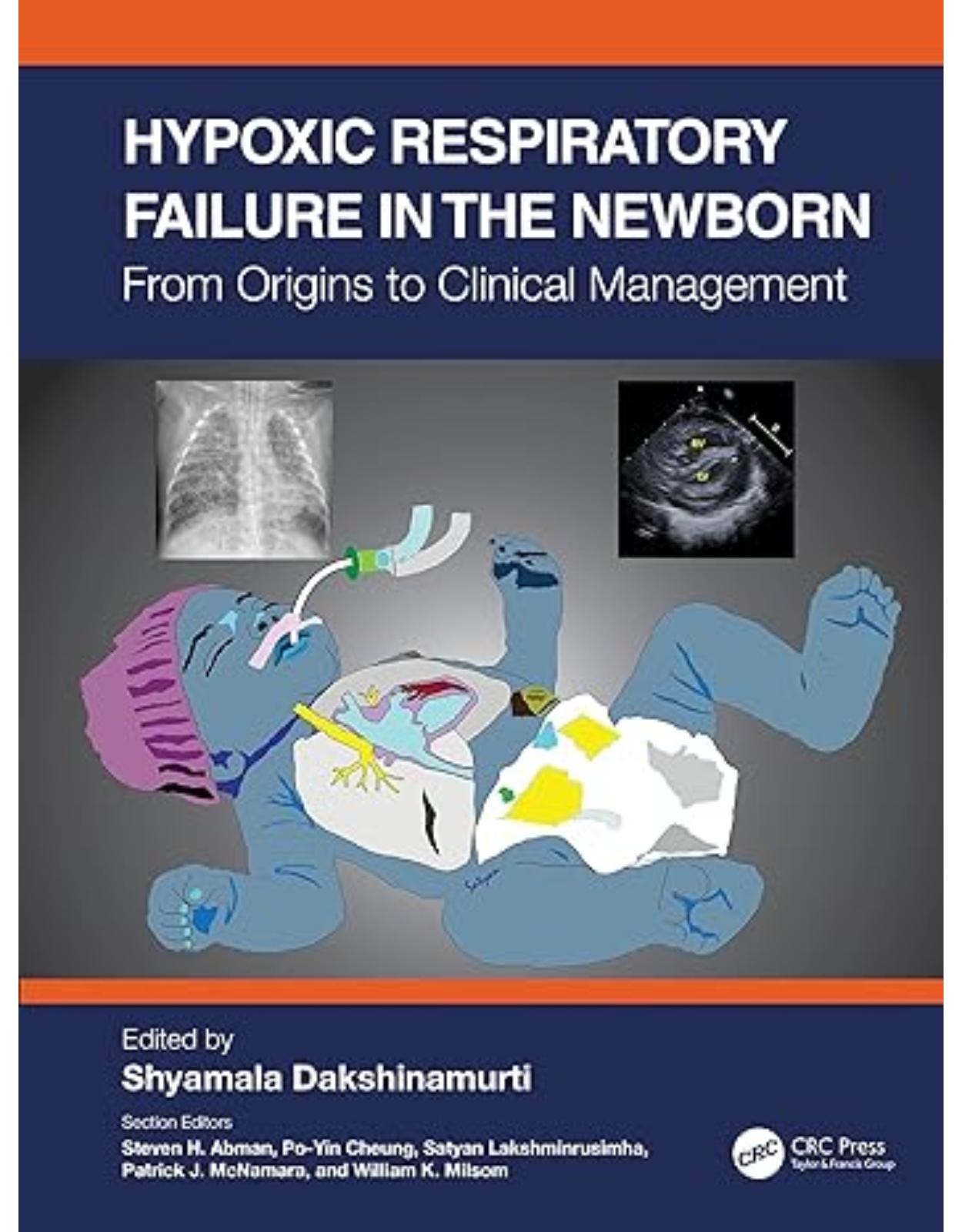 Hypoxic Respiratory Failure in the Newborn: From Origins to Clinical Management 