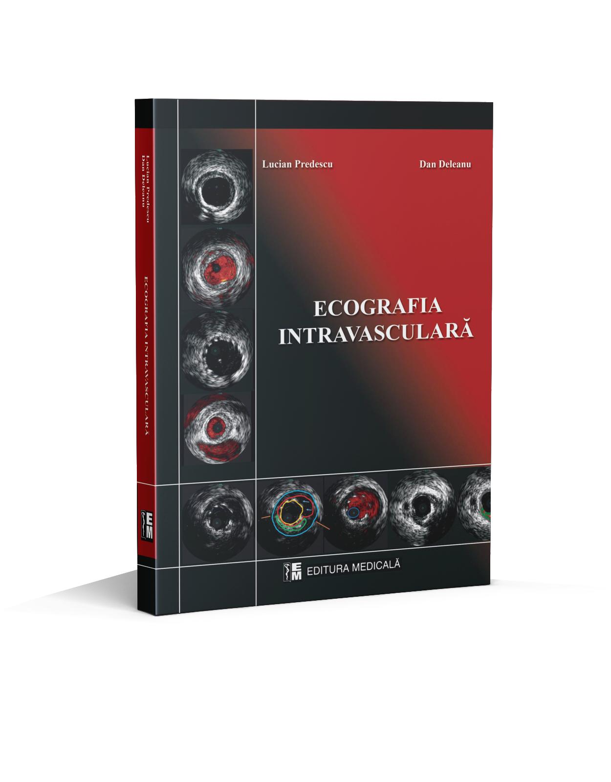Ecografie intravasculara