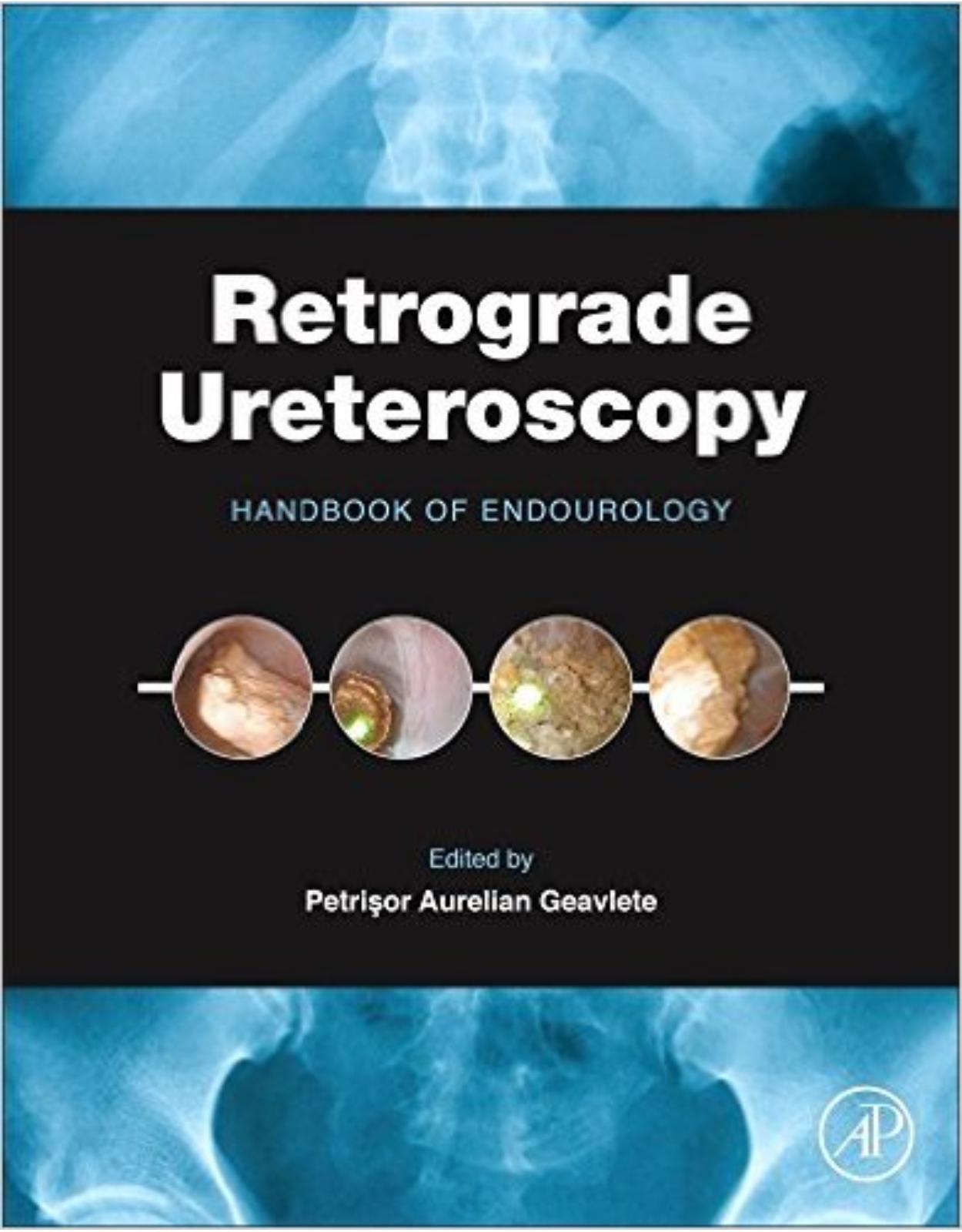 Retrograde Ureteroscopy: Handbook of Endourology