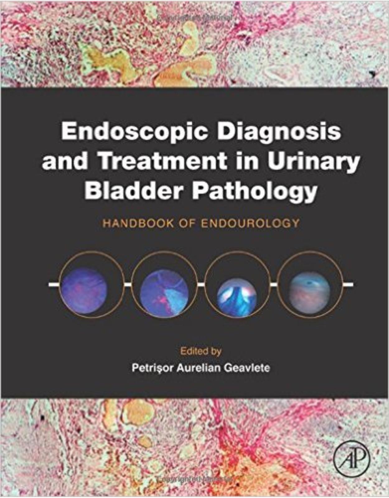 Endoscopic Diagnosis and Treatment in Urinary Bladder Pathology: Handbook of Endourology