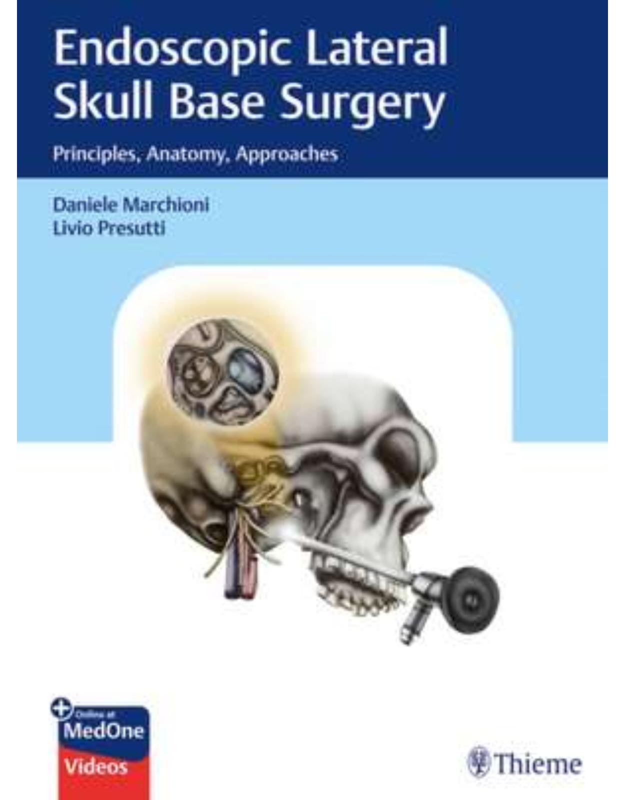 Endoscopic Lateral Skull Base Surgery 