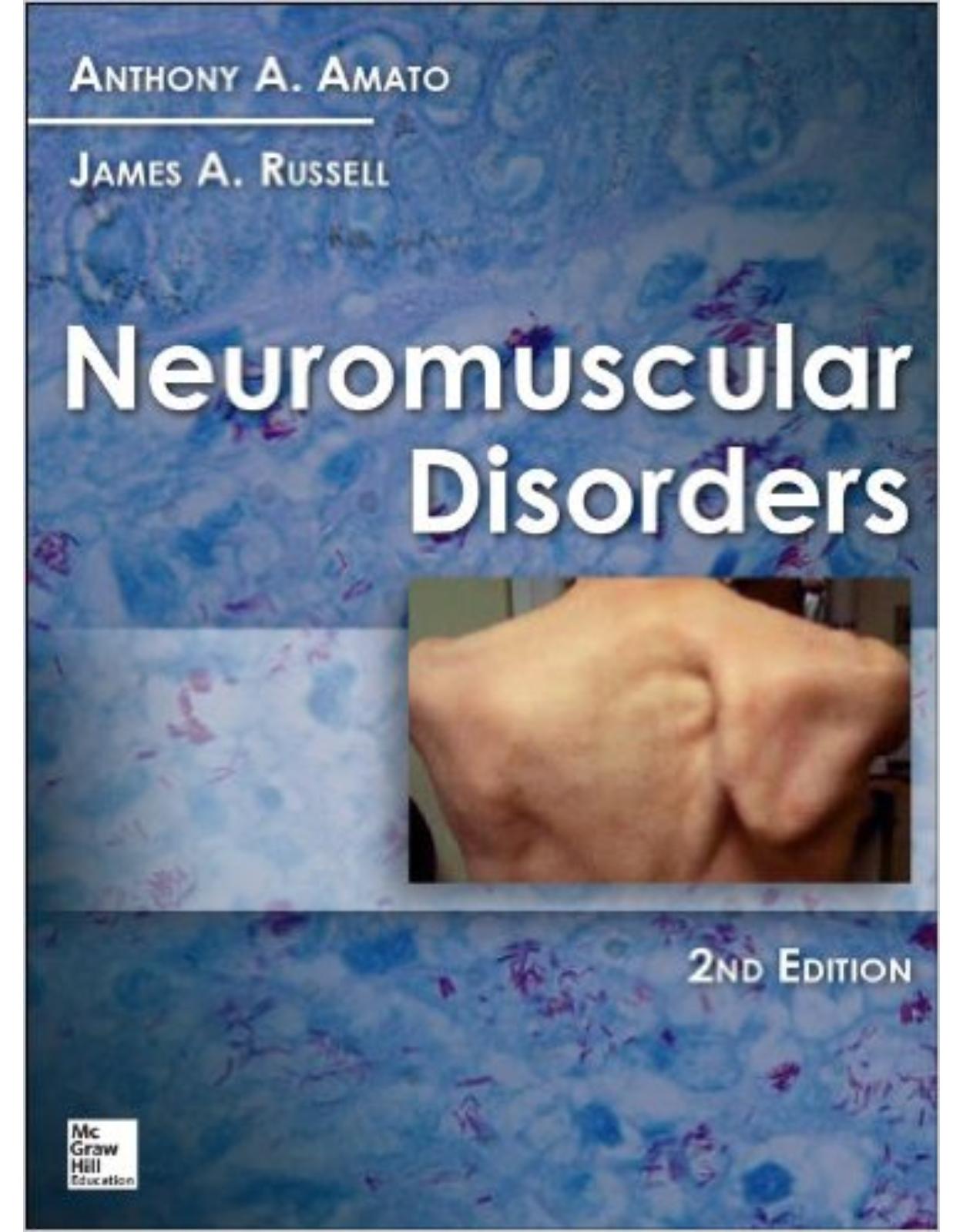 Neuromuscular Disorders