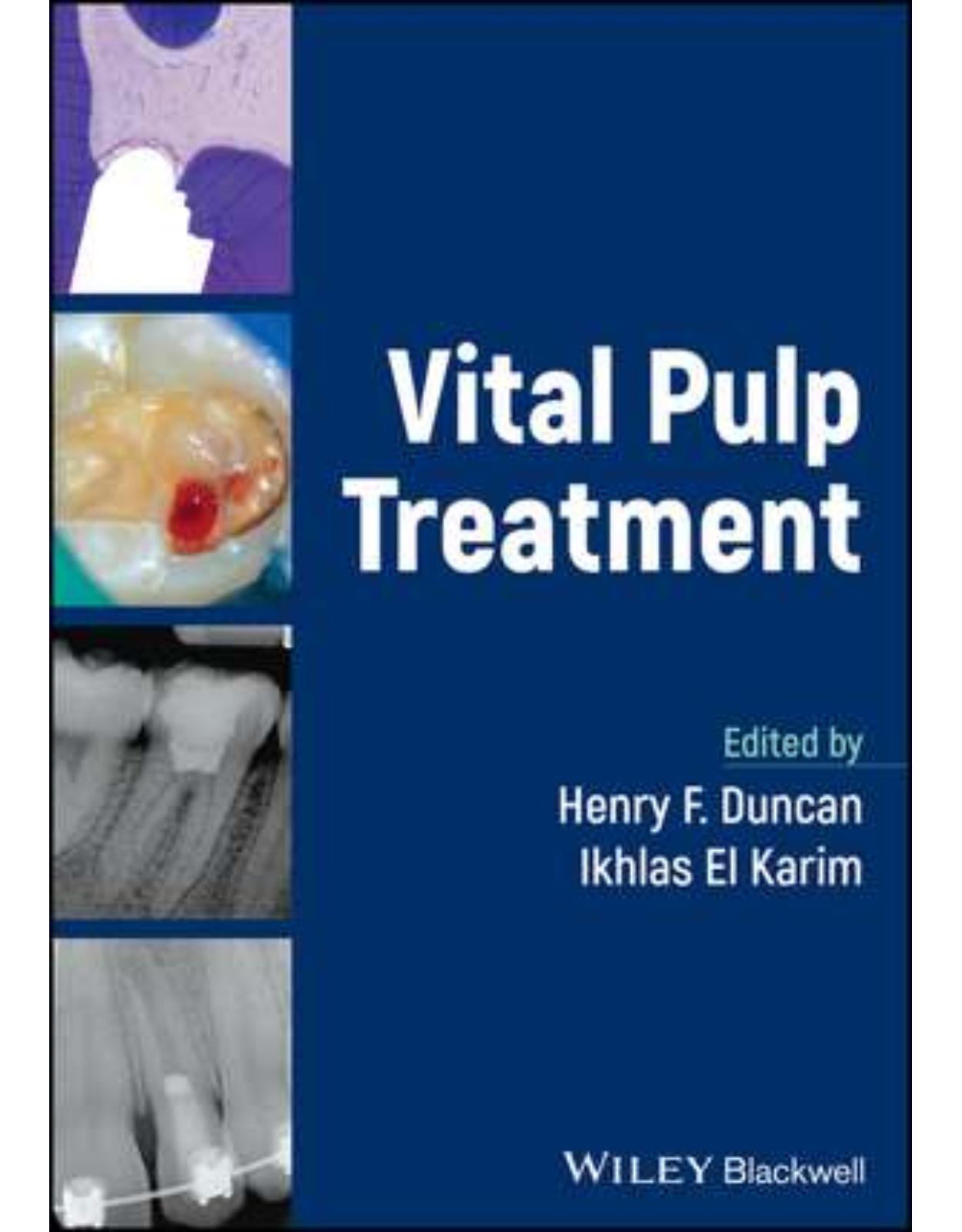 Vital Pulp Treatment