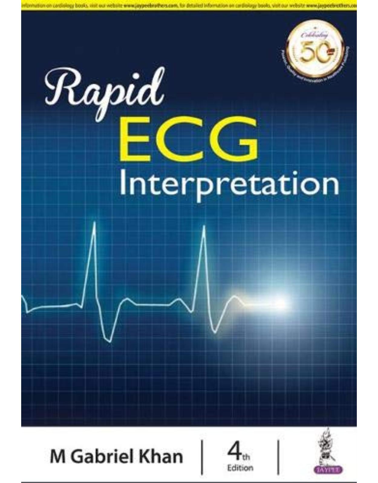Rapid ECG Interpretation
