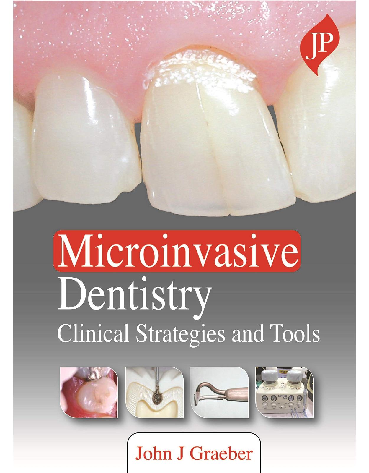 Microinvasive Dentistry: Clinical Strategies and Tools