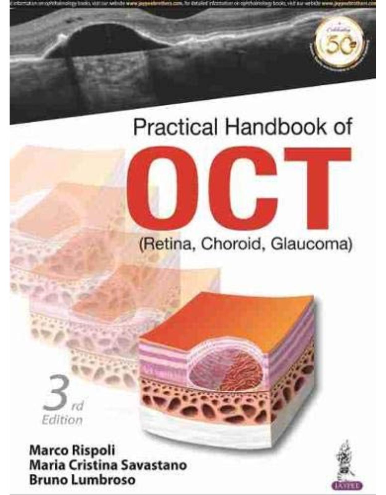 Practical Handbook of OCT: (Retina, Choroid, Glaucoma) 