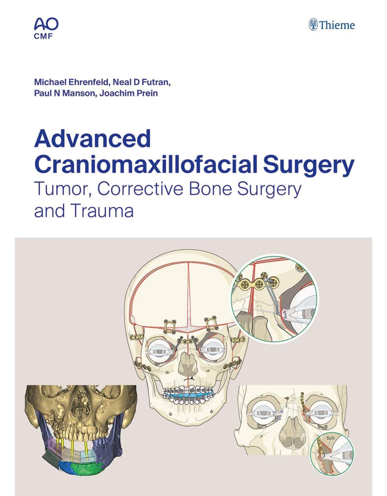 Advanced Craniomaxillofacial Surgery: Tumor, Corrective Bone Surgery, and Trauma