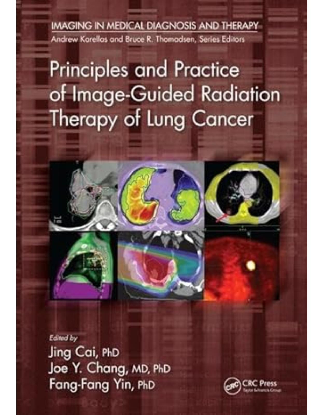 Principles and Practice of Image-Guided Radiation Therapy of Lung Cancer