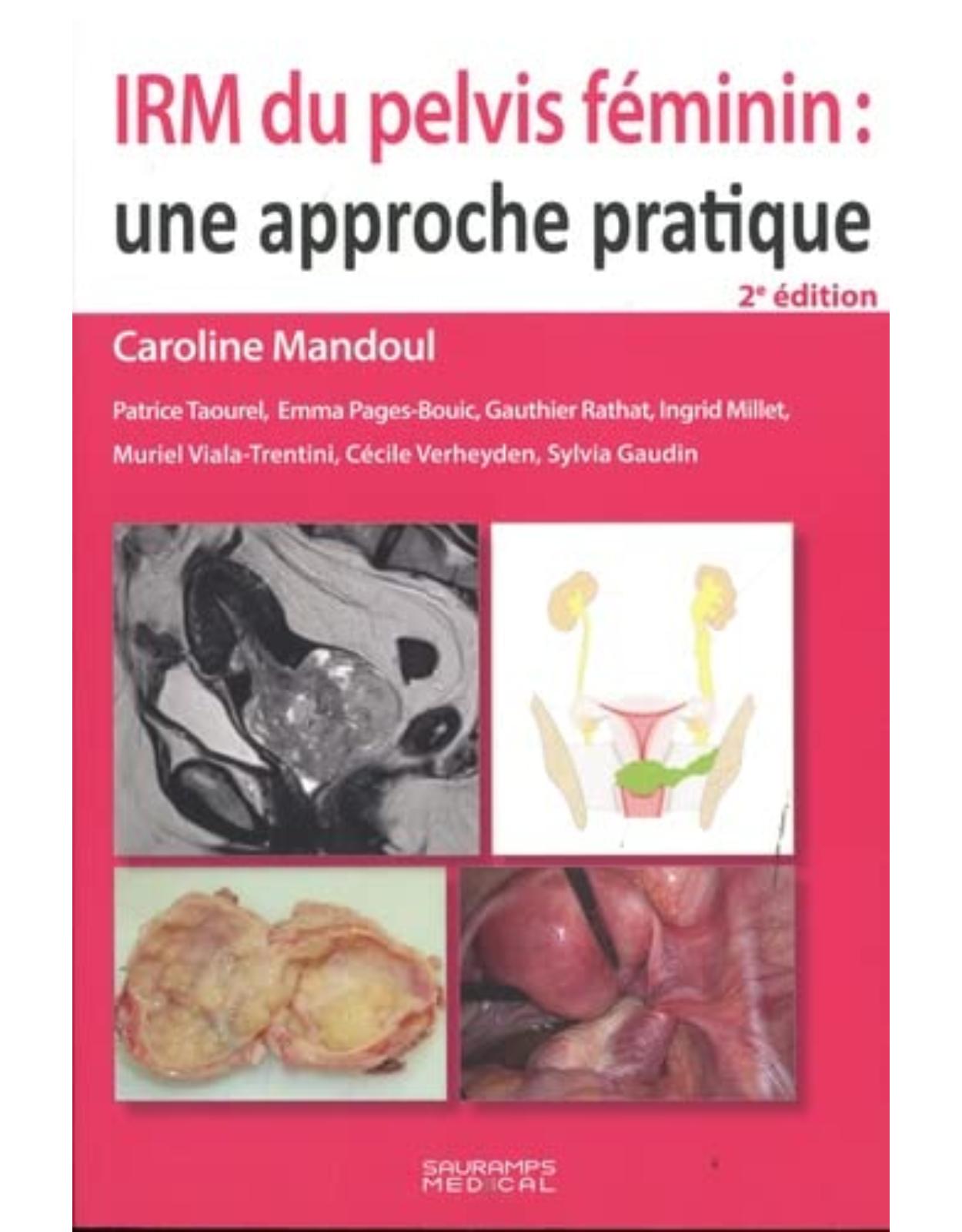 IRM DU PELVIS FEMININ : UNE APPROCHE PRATIQUE