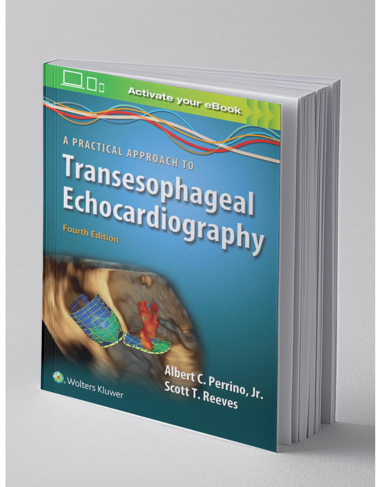 A Practical Approach to Transesophageal Echocardiography