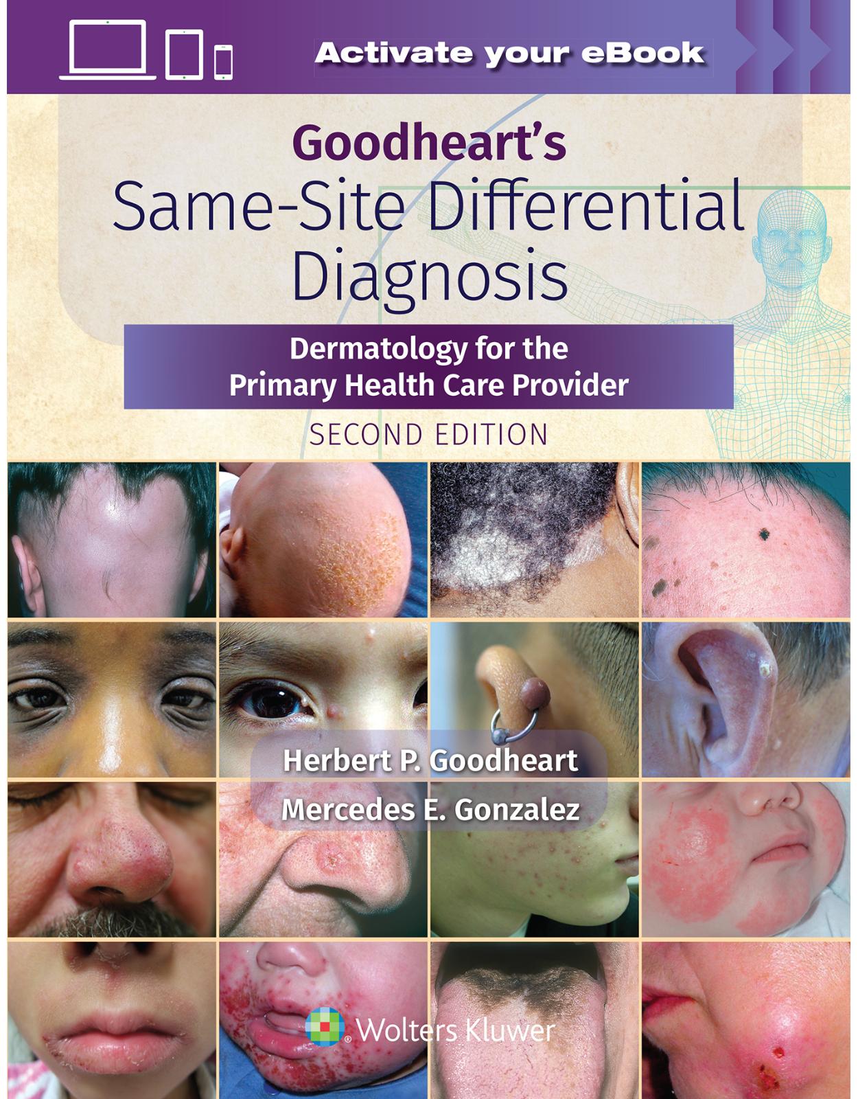 Goodhearts Same-Site Differential Diagnosis Dermatology for the Primary Health Care Provider, Second edition